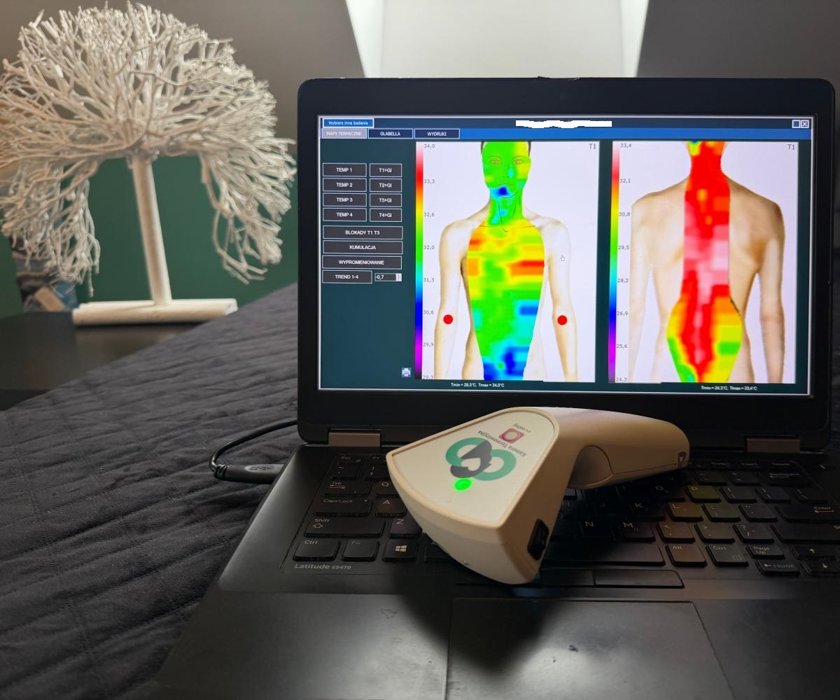 Metoda STRD – pirometr diagnostyczny